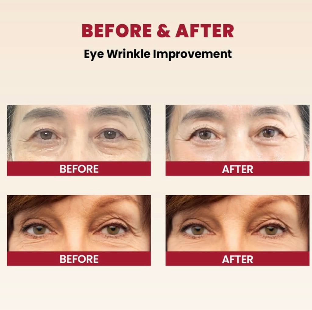 K-Secret Seoul 1988 Eye Cream: Retinol Liposome 4% + Fermented Bean