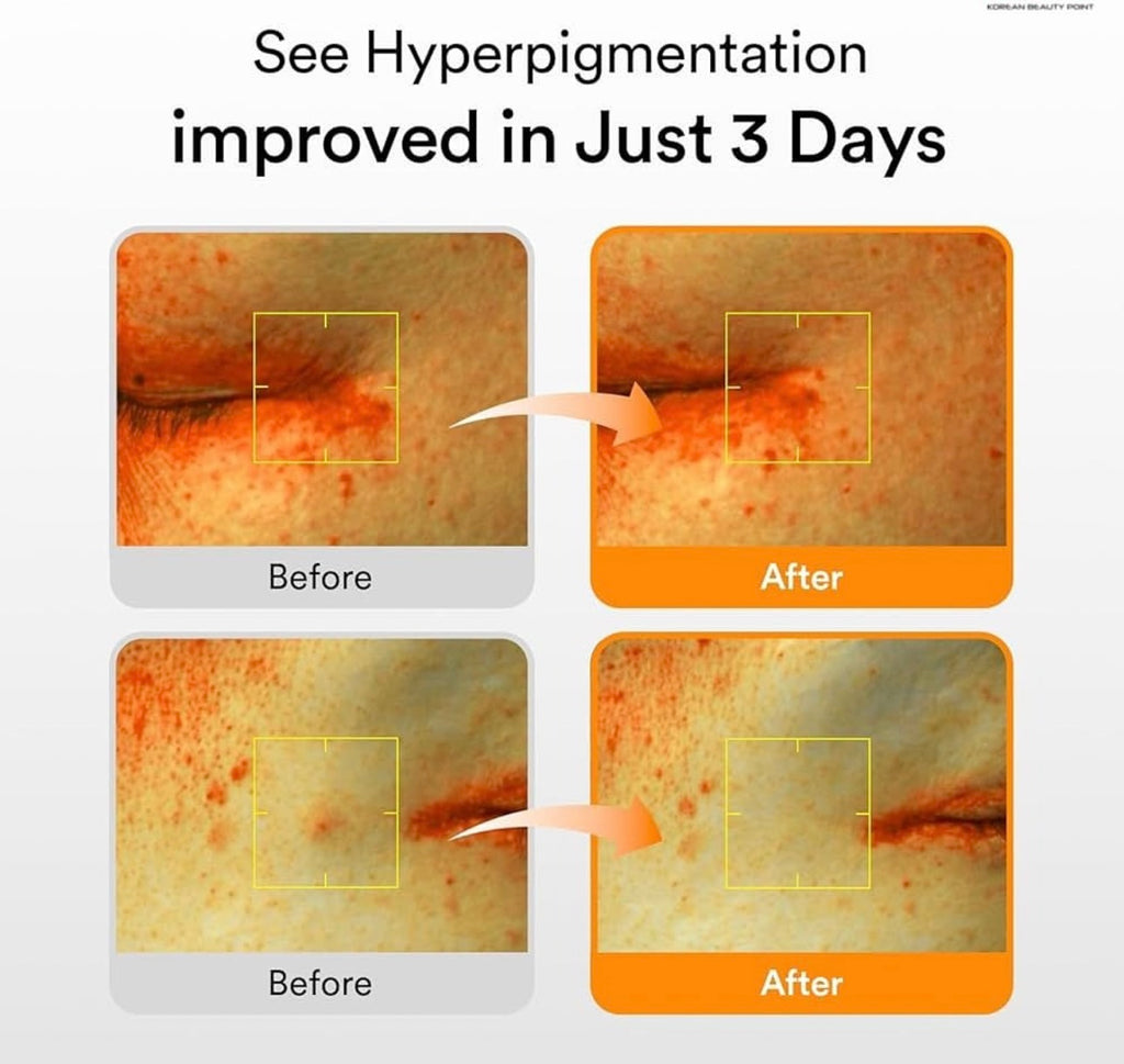 Abib Glutathione Dark Spot Serum 50ml