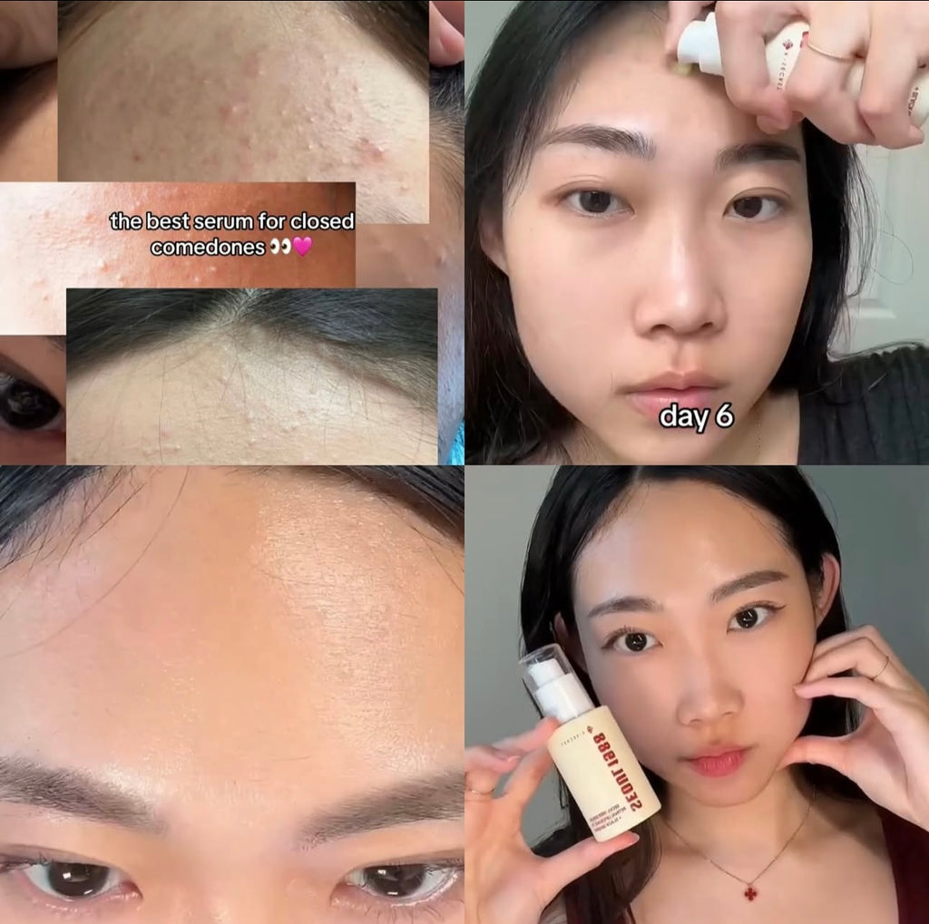 K-Secret Seoul 1988 Serum: Retinal Liposome 2% + Black Ginseng 30 ml